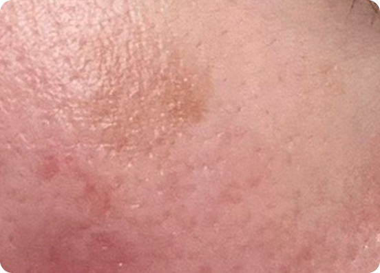 จุดด่างดำ