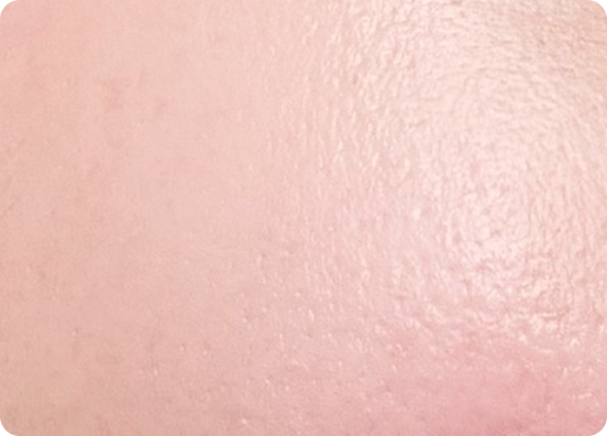 ผิวกระจ่างใส